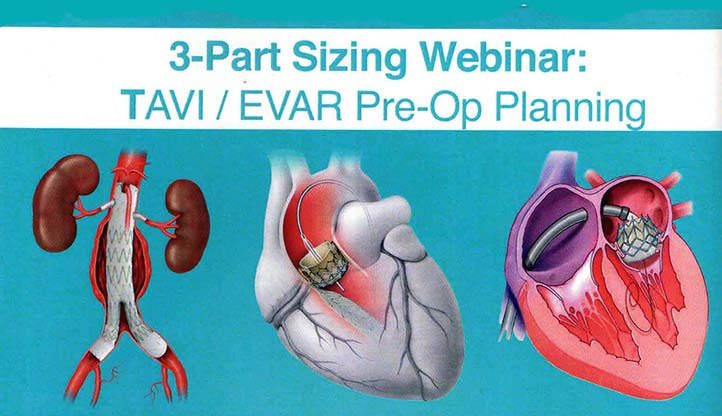 Three-Prt Sizing Webinar: TAVI/EVAR Pre-Op Planning
